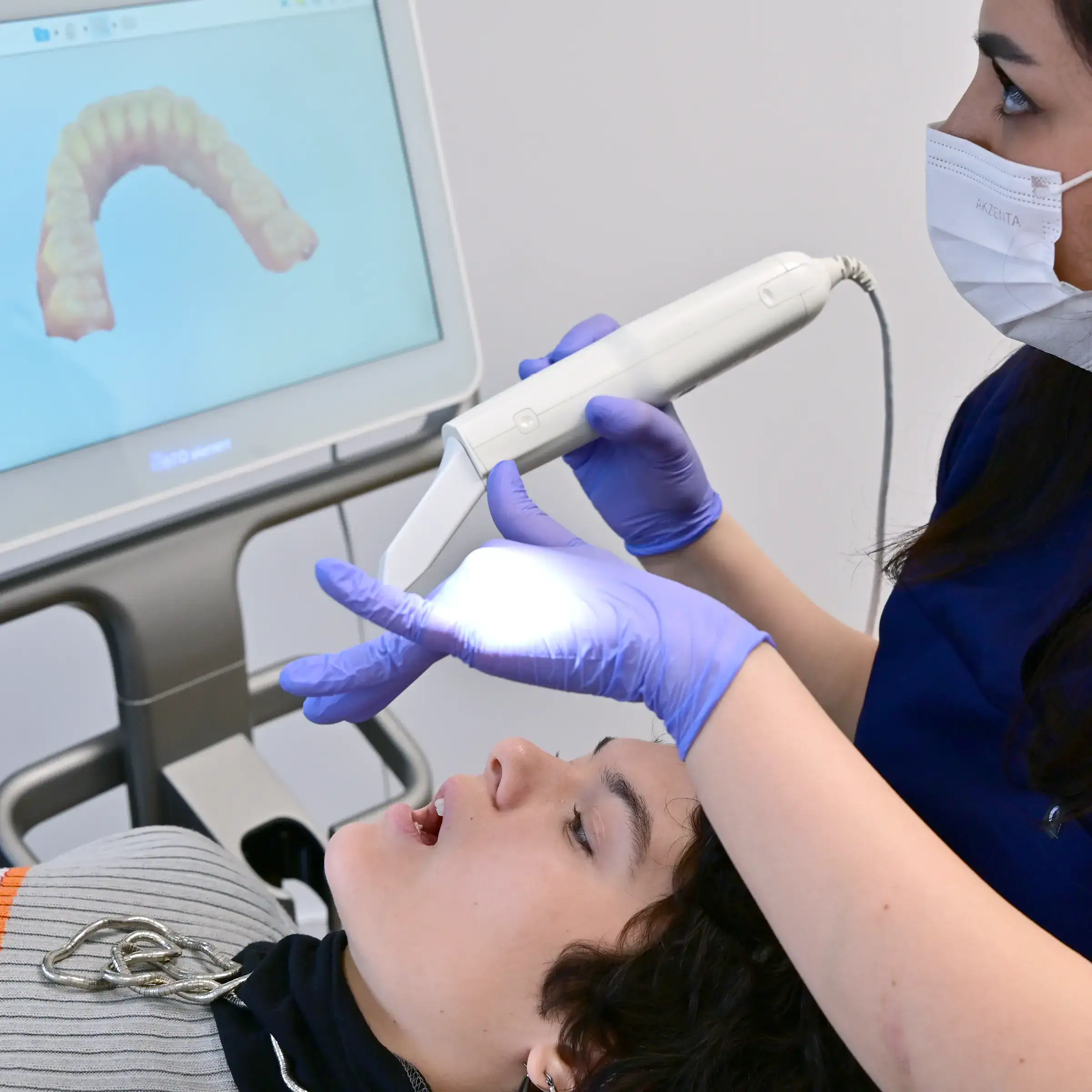 CMD Behandlung Köln bei Zahnfreude Kieferorthopädie – Diagnostik bei einer Patientin mittels 3D Scan.