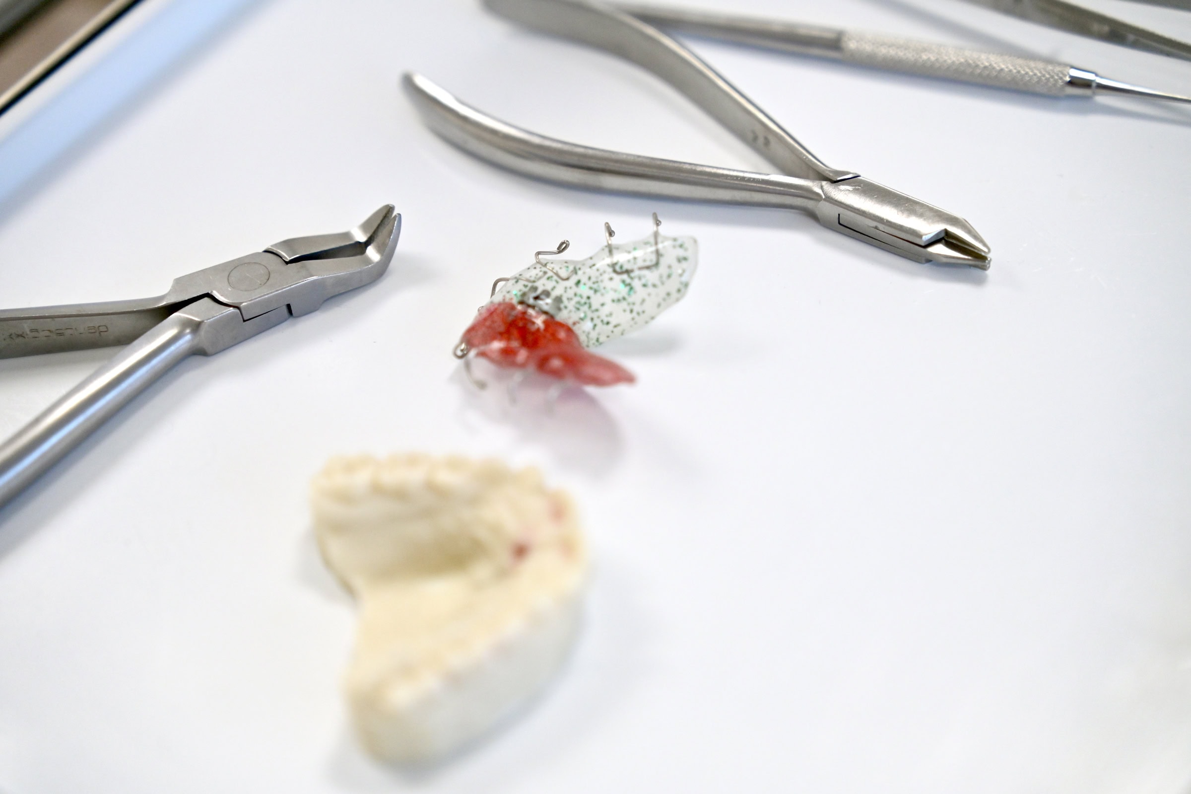 Lose Zahnspange Köln – individuelle Farbwahl