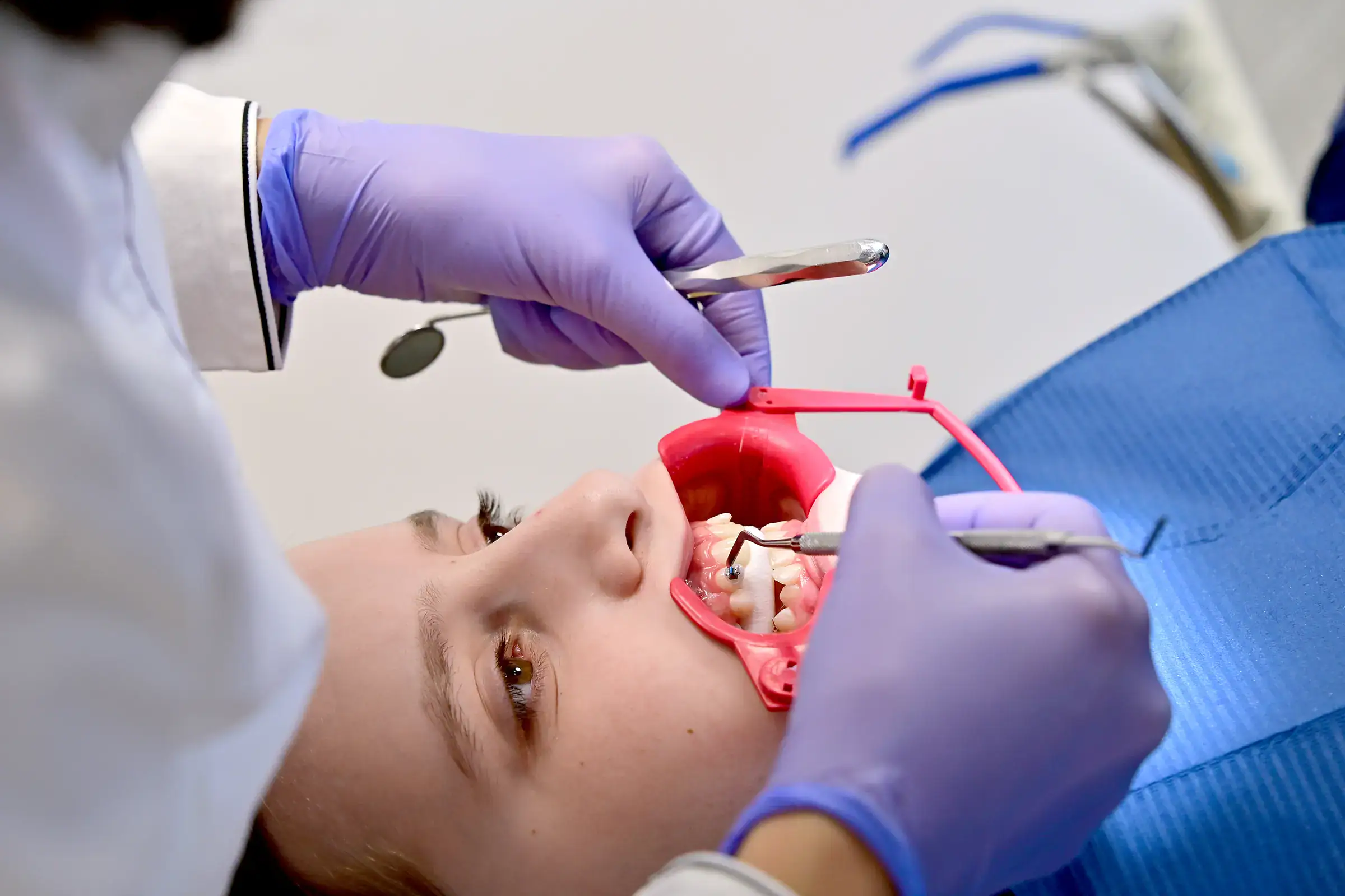 feste-zahnspange-brackets