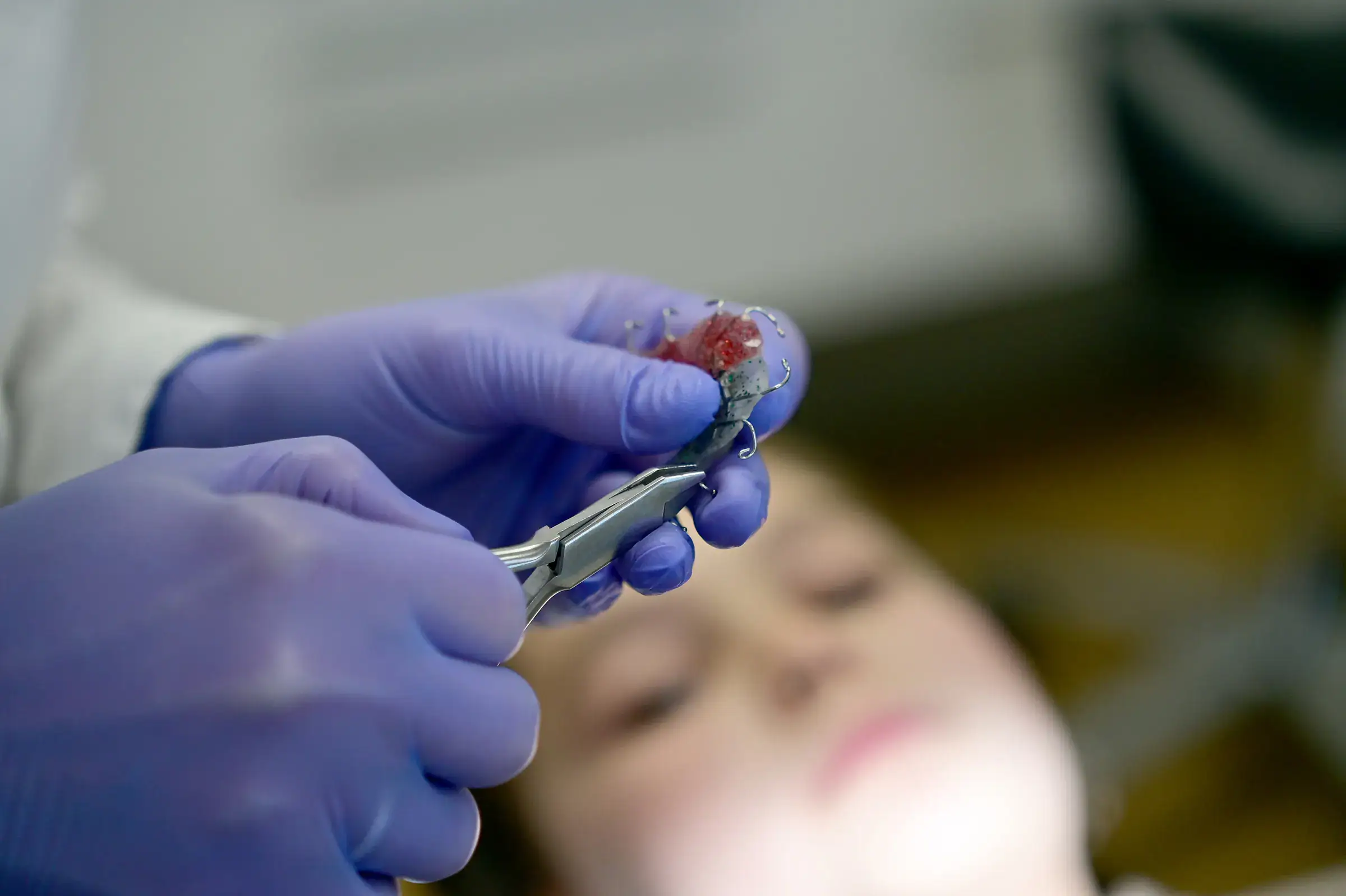 Lose Zahnspange Köln bei Zahnfreude – Zahnspange wird mit einer Zange feinjustiert