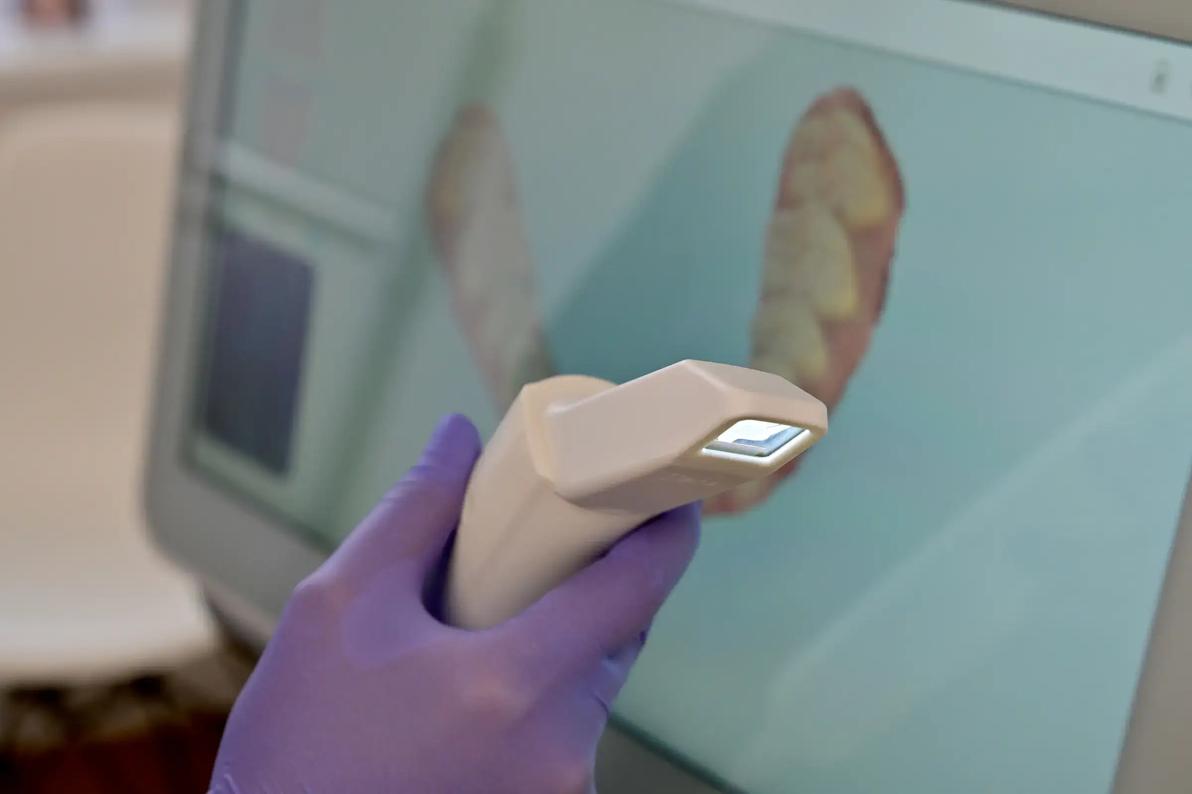 Digitale Kieferorthopaedie Köln – Intraoralscanner und Monitor